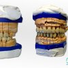 manchegos-protesis-dental-maquetas-rehabilitacion-02.jpg
